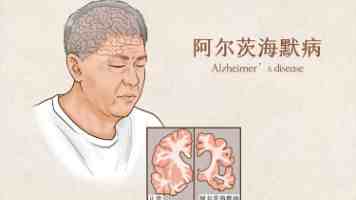 香蕉兄妹 - 走红真相与家庭日常互动背后的流量密码